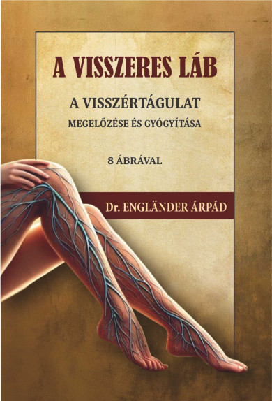 Könyv A visszeres láb a visszértágulat megelőzése és gyógyítása (Dr. Englnde